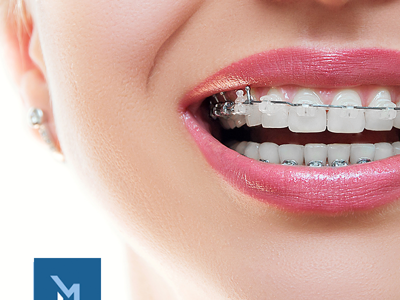 Medyclinic Clínica Dental