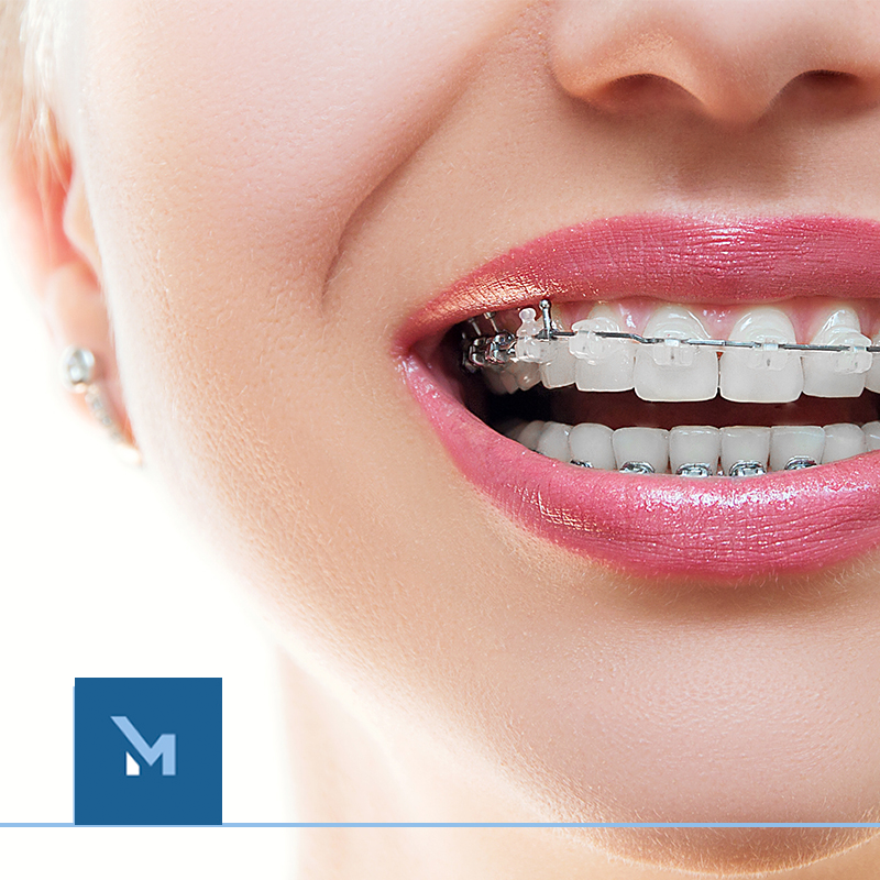 Medyclinic Clínica Dental